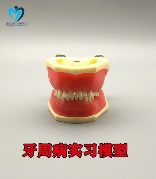 牙科 口腔教学展示练习 牙周病实习模型可拆卸软牙龈仿真树脂牙粒