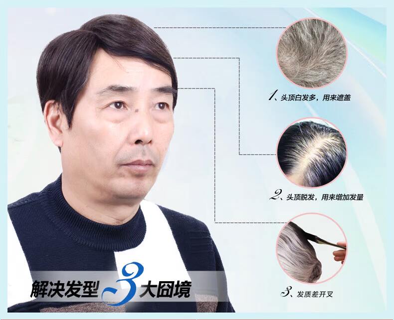 Extension mèches - Ref 225864 Image 10