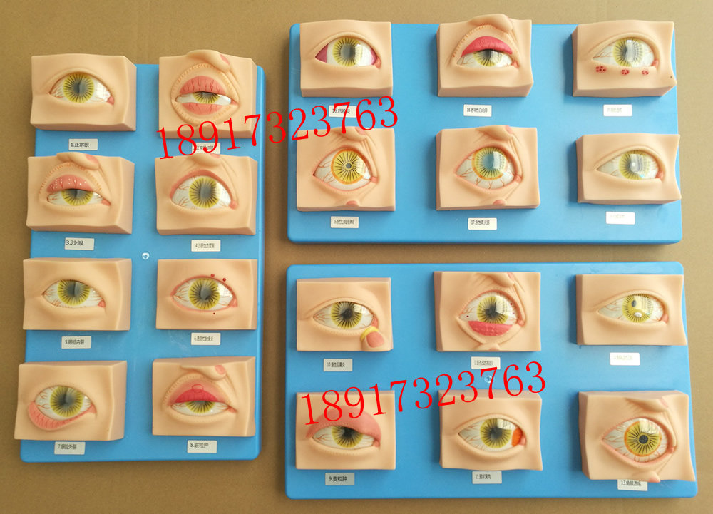 常见眼病模型20种 眼睛疾病模型 眼科常见疾病模型 眼球病变模型