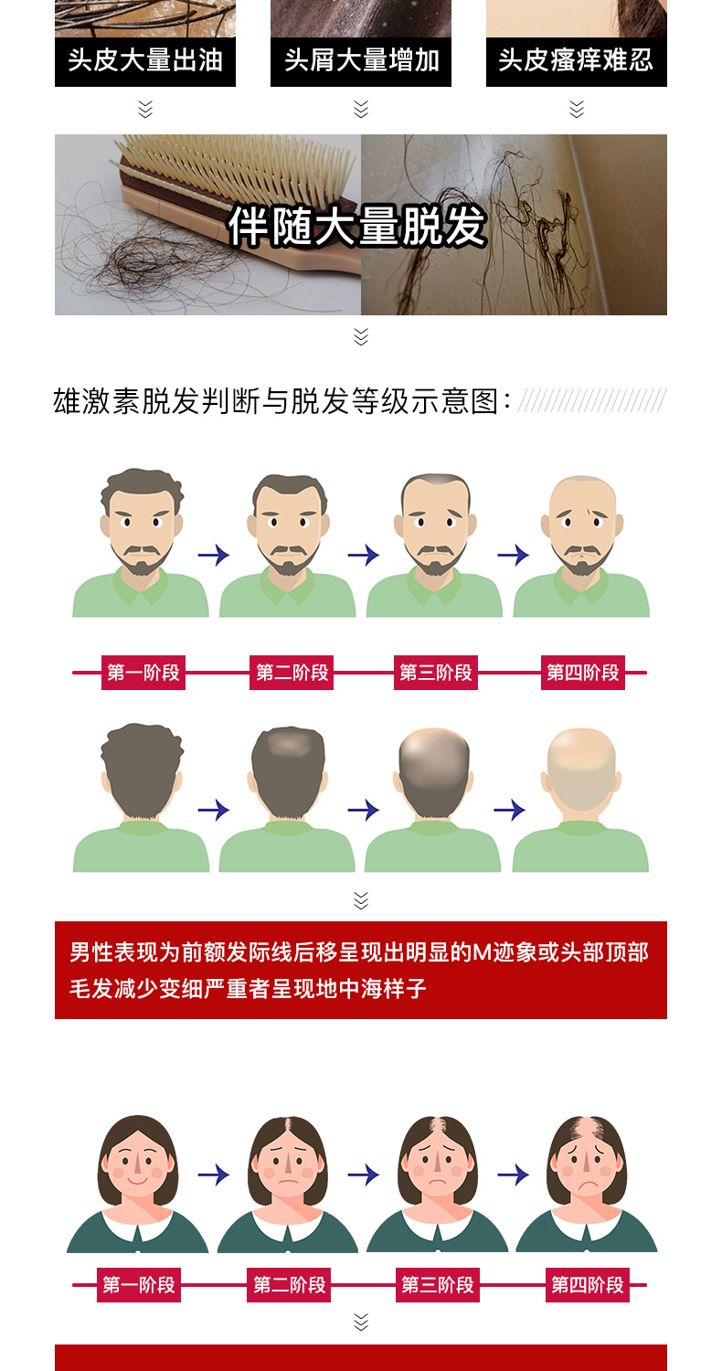 达霏欣 5%米诺地尔酊搽剂 防脱发生发增发液 30ml 图7