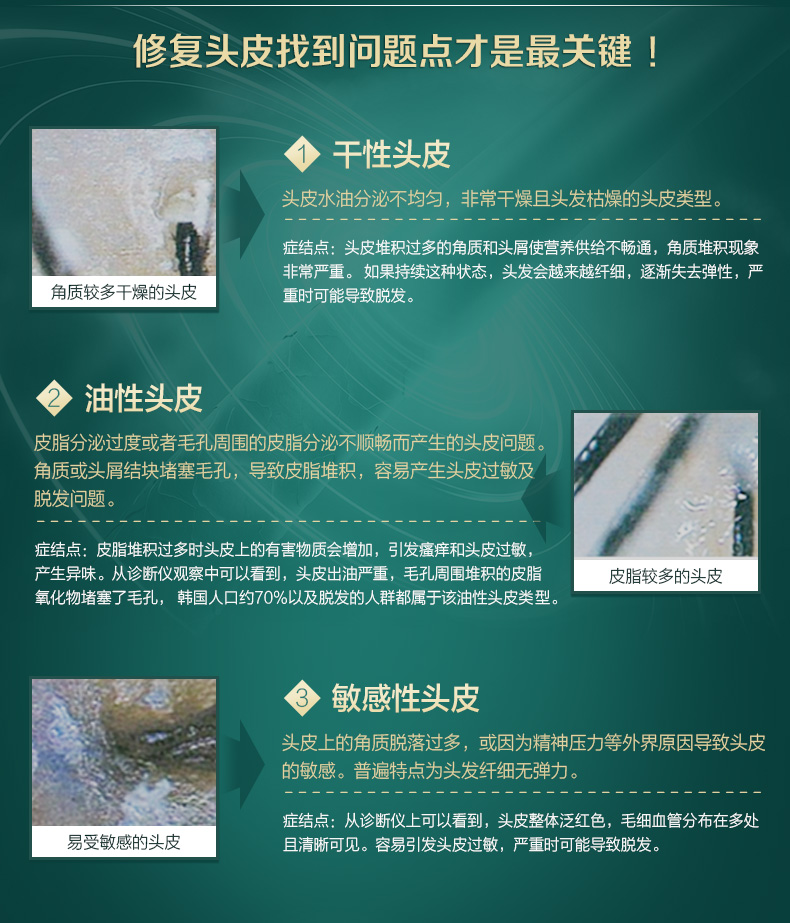 韩国原装进口 Ryo绿吕 舒盈清润控油无硅油洗发水 500ml*3瓶 图5