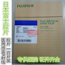 Fujifilm X-Ray Blue Film X-Ray Film 11*14 inches also have other specifications