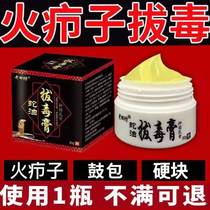 Treating the firewood toxin cream with pimples of pimples swollen lump hair sac suction abscess