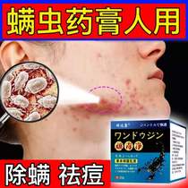 Anti-acne removal star with a cured pest bite on the face of the anaemia deitch artist