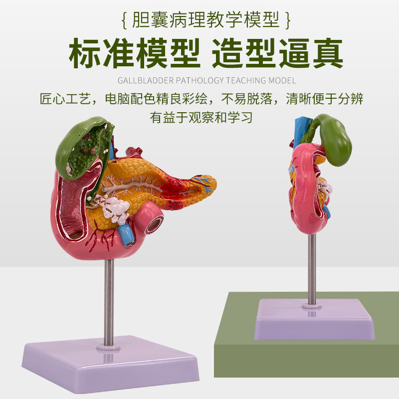 震惊!医学生都在偷藏的肝胆模型,居然能这么真实?😱 胆结石、胰腺癌全看透!-其他模型玩具-淘宝好物网