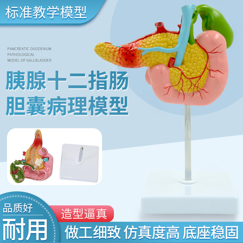 医学胰腺十二指肠胆囊病理模型 胆结石外科消系统肝胆科模型