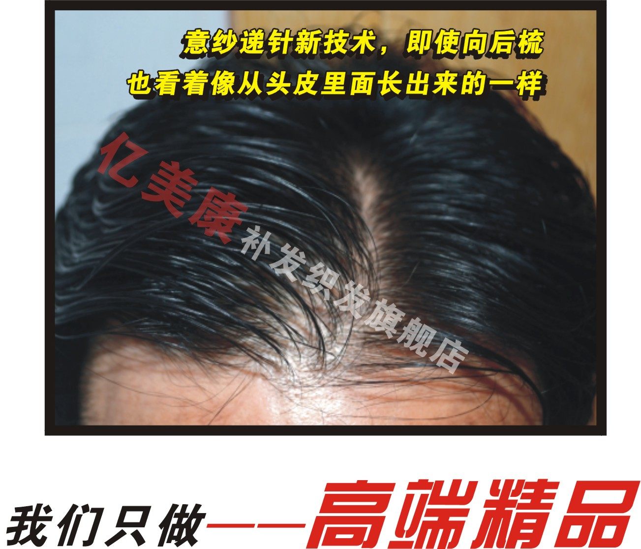 Men's ladies tonic hair textured hairless boutique delivery needle invisible hair trail Bionic Membrane Tonic Hair Block Hair