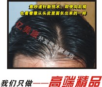 Mens and womens hair repair Woven hair without trace Boutique needle delivery Invisible hair line Bionic film Hair block hair piece