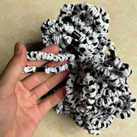 Около 100 пунктирных белых петель тонкой кишки.