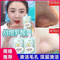 (Zhao Lusi recommended) Yacino deep cleaning mask salicylic acid oil control war acne mud film to close the mouth white mud