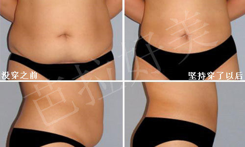 body amincissant sexy en nylon - Ref 670443 Image 14