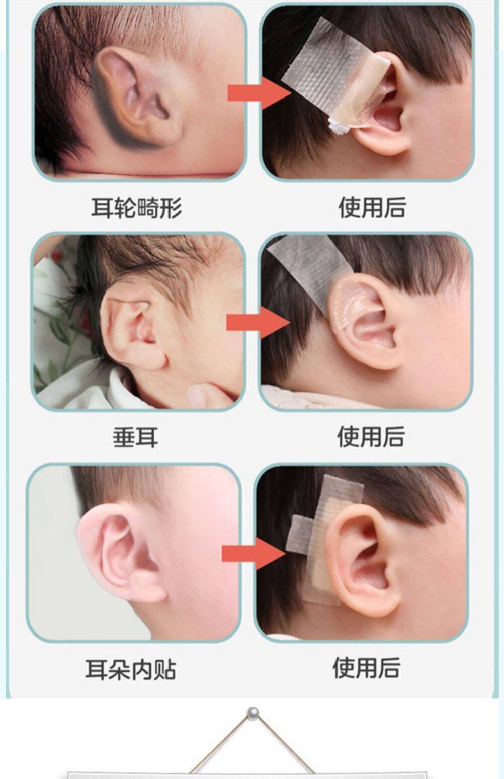 Audio Corrector Tape Corrector Handling Ear-outline Tape Newborn Plastic Silicone Gel