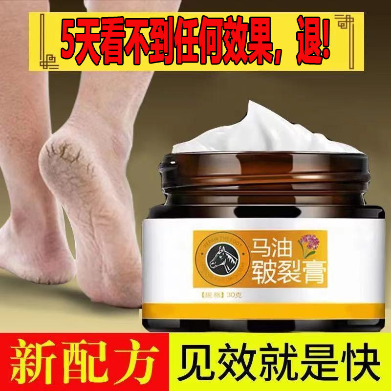 Nian kylin skin repair cream exhausted hands and feet chapped chapped heels dry crack anti-crack cream foot crack cream repair