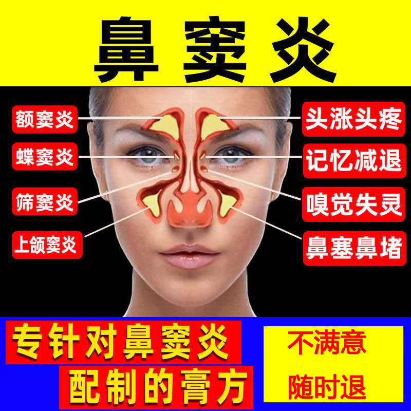 Rhinitis spray allergic nasal sinusitis nasal congestion turbinate hypertrophy drug radical cure nemesis ointment ventilation artifact