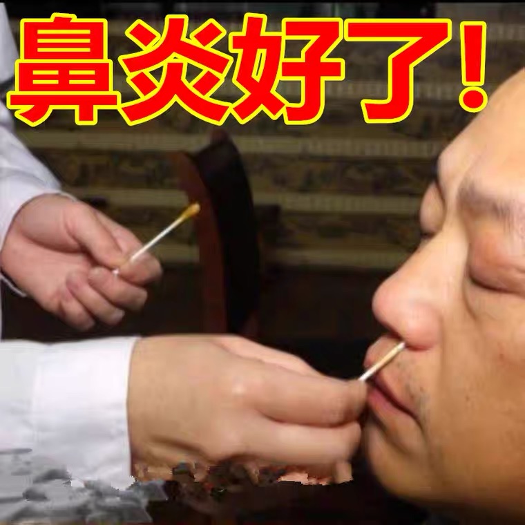 Rhinitis ointment radical cure nasal congestion nasal artifact spray allergy seasonal rhinitis sinusitis turbinate hypertrophy Biyan ointment