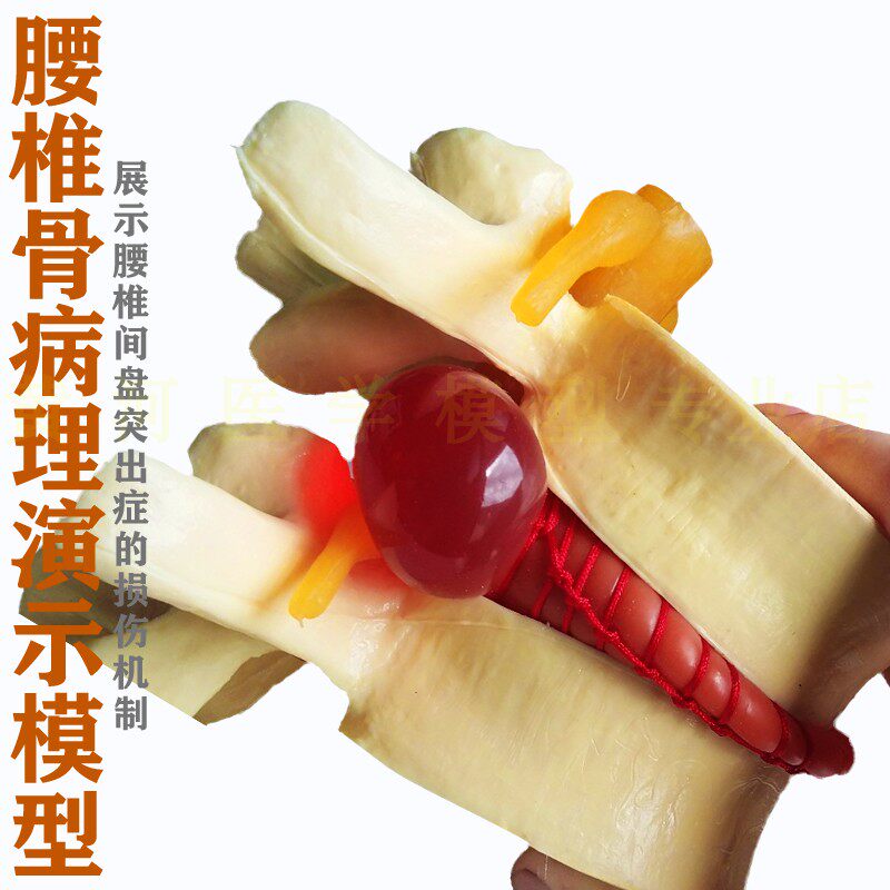 正品 腰椎模型人体腰椎间盘演示教具  脊柱模型 脊椎模型关节模型
