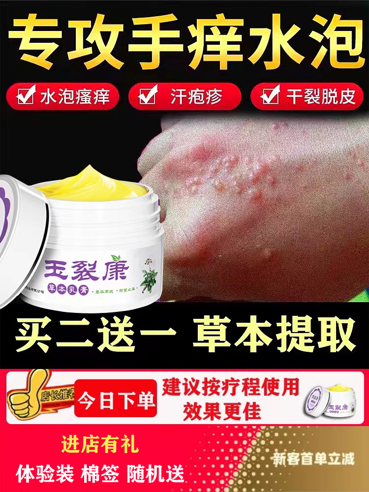 手上长小水泡？这护理科技真刚刚管用✨