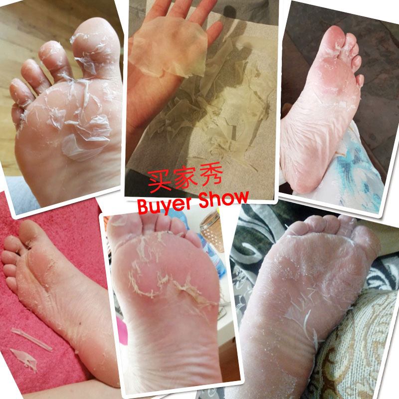 Mặt nạ chân đặt chân cho da chết Callus tẩy tế bào chết làm trắng da mặt lột kem bôi gót chân