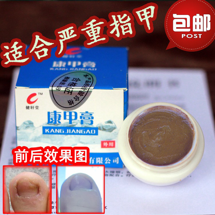 Jianxuan Kang Nail Cream Is Specially Designed for Severe Toenail Problems. Suitable for Use on Nails That Have Been Thickened for Ten Years. 10g Genuine Product