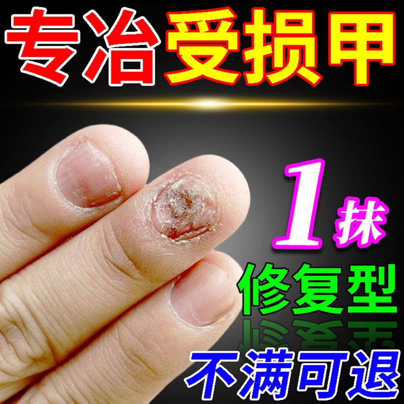 Nail Bed Nail Repair Solution for Damaged and Regenerating Nails, Separation and Growth Solution for Nail Beds, for Chipped, Cloudy, Uneven Nails
