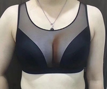 Usa 3D cleavage breast augmentation adjustment sexy small chest bra no steel ring gathering thick bra sports underwear