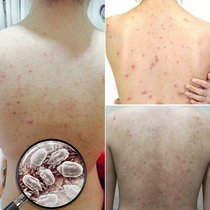 Net red trembles with natural sea salt soap mite soap sulfur soap sterilization face body back face face face face face mite soap