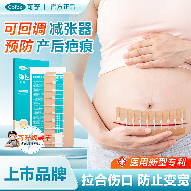 可孚医用减张器剖腹产术后伤口愈合皮肤疤痕贴可回调免缝拉合祛疤