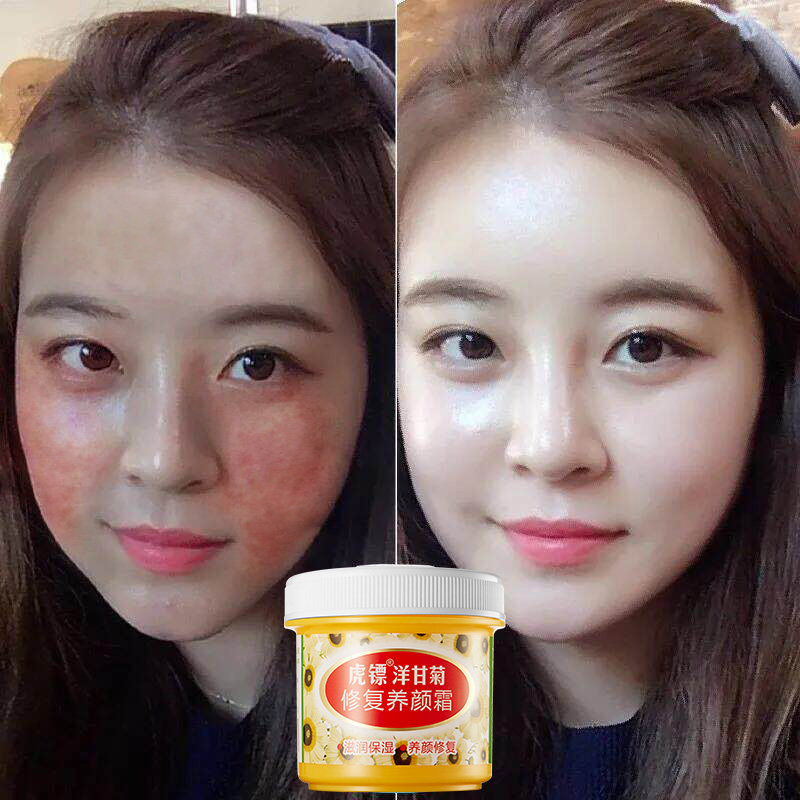 Tiger dart removes red repair corner layer thickened Shu anti-over frost sensitive skin Skin Cream Special Skincare