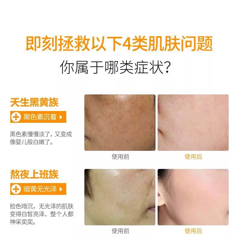 Làm trắng da thực phẩm Ampoule tinh chất dưỡng ẩm tàn nhang làm sáng da săn chắc da mặt axit hyaluronic giải pháp tinh chất kiehl's