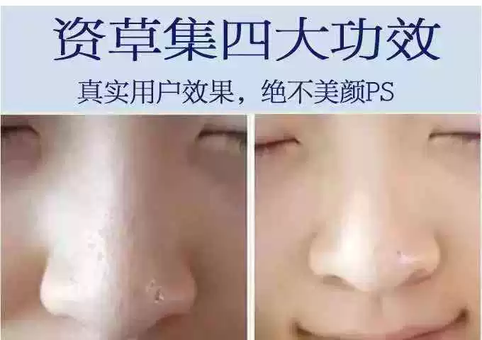 Làm xanh da thủy tinh trẻ hóa da làm sạch sâu lỗ chân lông Kem massage mặt làm sạch da mặt - Kem massage mặt kem massage mặt spa