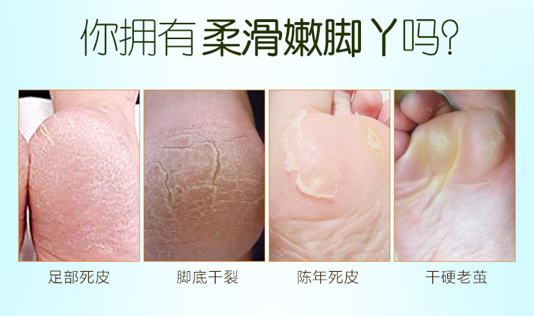 Chân Chà Mặt Nạ Chân Tẩy Tế Bào Chết Chăm Sóc Bàn Chân Cũ Kem Tẩy Tế Bào Chết Mặt Nạ Chân Đẹp Chân Mắt Cá Chân Kem Lột thuốc trị nứt chân