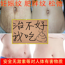 Stretch marks postpartum lightening fat repair cream removing breasts and breasts to eliminate pregnant women to prevent belly tightening renchen lines