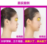 Японские ноздри ринопластика сузили нос и нос, нос, коррекция носа, маленький артефакт, женщина -носовой мост.