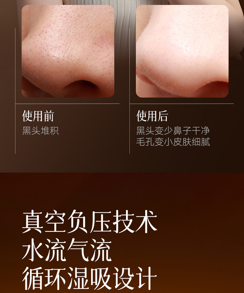 【中國直郵】 康佳 吸黑頭神器 美容儀家用臉部小氣泡黑頭毛孔清潔吸出