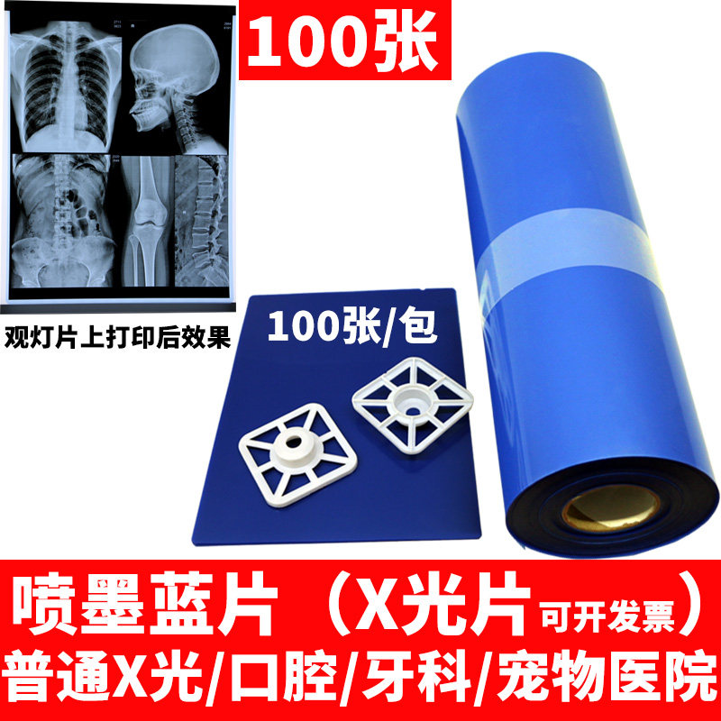 Inkjet blue film A4 medical film dry printing film dental film X-ray 100DR film 8*10 10*12 11*14