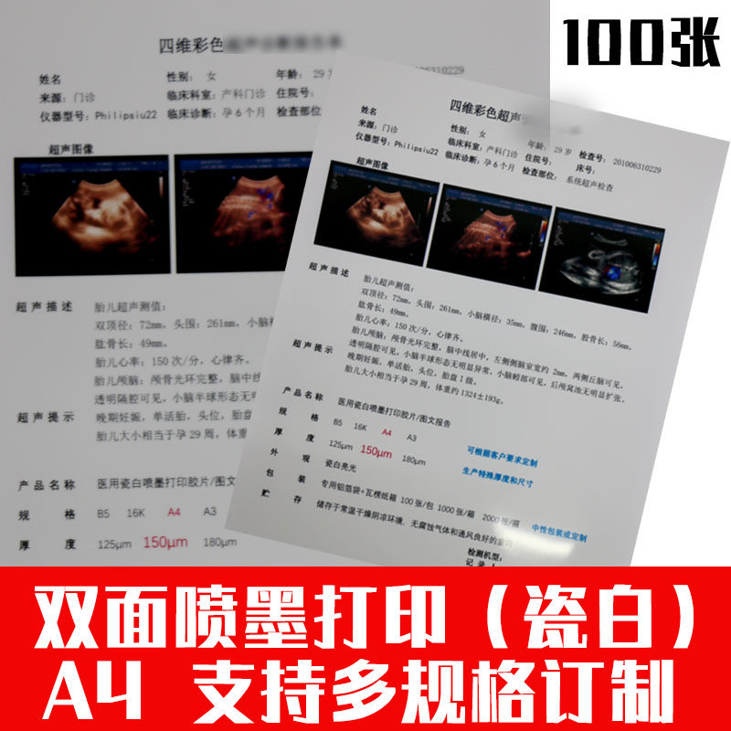 Porcelain White Inkjet Double-sided A4 Printing Film B Ultrasound Color Ultrasound Report Medical Film Paper 16K Special B5 - Taobao