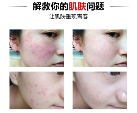 草 毒素 毒素 website trang web chính thức kem massage mặt thật độc tố làm sạch lỗ chân lông nữ kem tẩy trang hàn quốc
