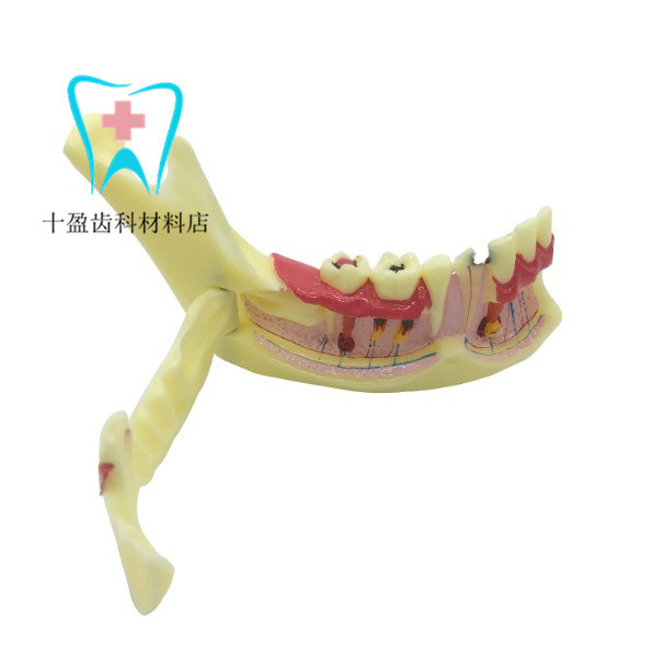 Doctor-patient communication explanation for the jaw bone breakdown model under the dental oral teaching model