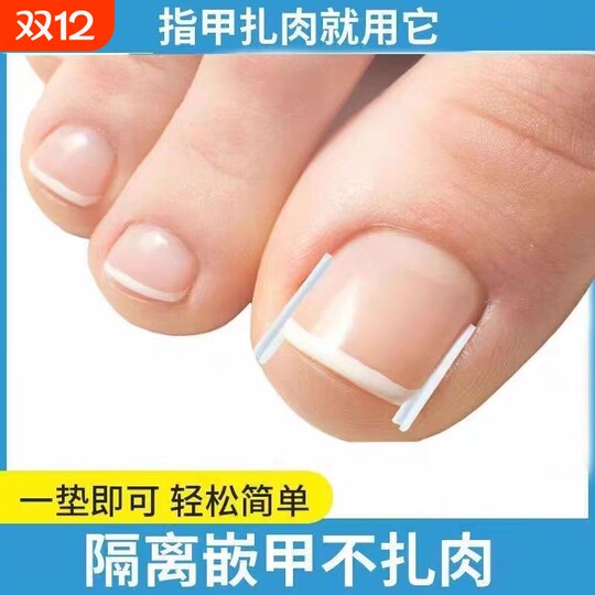 Ingrown toenail correction pad | Over 6,000 additional purchases