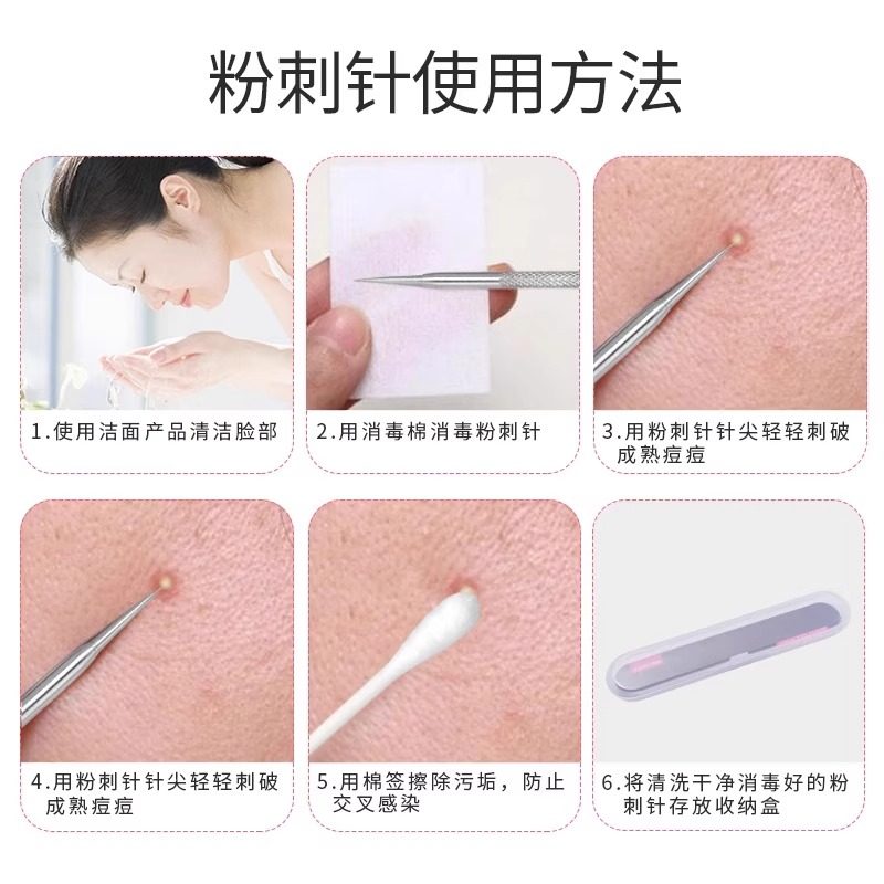 粉刺针细胞夹套装暗疮针镊子挤痘痘美容院清洁工具面部按摩脸部 5