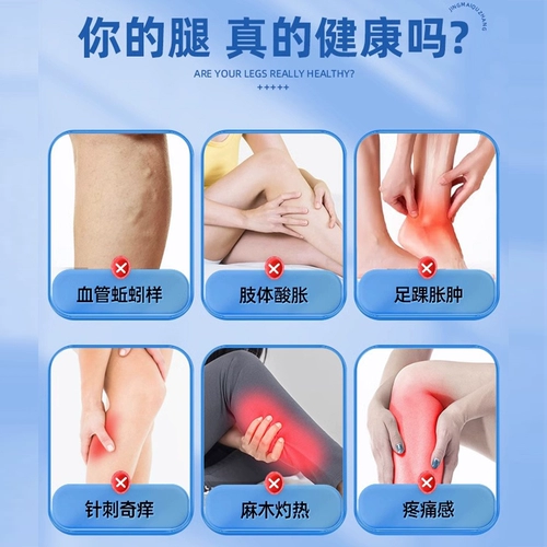 Пекинские коллеги варикозной варикозы, холодные гелевые зеленые сухожилия, поднятые кабели сперматозоидов с лекарственной пастой после официального подлинного 7