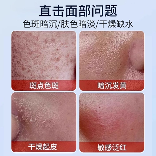 Никотинамидный гель официальный флагманский флагманский магазин de -genuine кожаный научно -исследовательский институт Несоомедикальный отбеливание, веснушка, сливки, тминилин