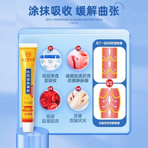 Пекинские коллеги варикозной варикозы, холодные гелевые зеленые сухожилия, поднятые кабели сперматозоидов с лекарственной пастой после официального подлинного 7