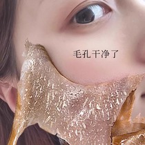 (Recommended by Xiaohongshu) Deeply remove facial dirt and deep clean facial pores clogged with dirt and garbage