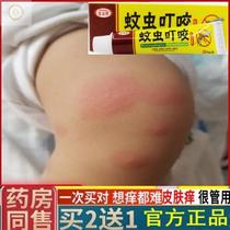 Ant bite ointment mosquito bite anti-itching and swelling ointment flea ointment for adults with itchy skin