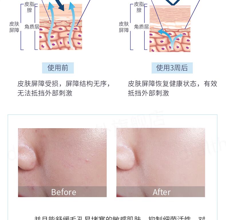 Dr. Althea Chi Chia Gum Extract Repair Cream 50ml dưỡng ẩm giữ ẩm làm săn chắc cơ bắp - Kem dưỡng da kem dưỡng ẩm chống lão hóa