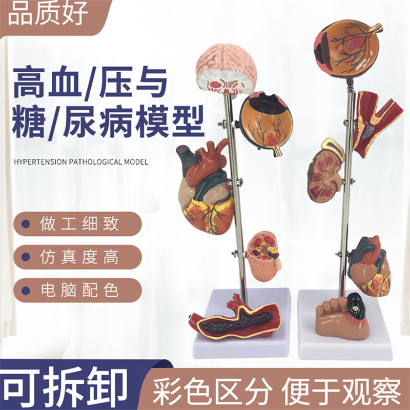 糖尿病靶器官模型 糖尿病并发症模型 高血压病理模型