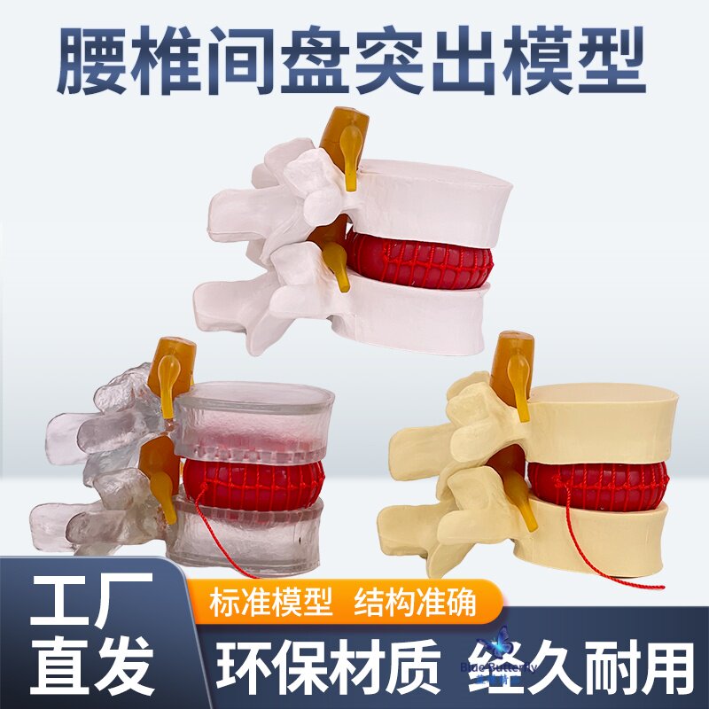 教学仿真人体腰椎间盘演示突出模型脊柱测压演示脊椎压力病变脊椎