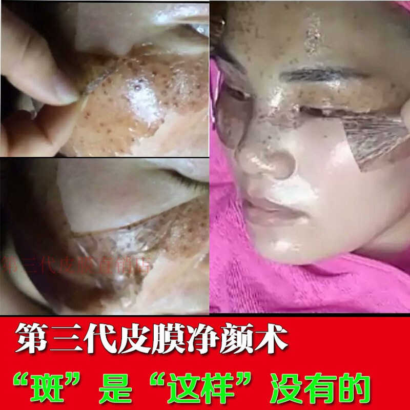 Authentic Beauty Salon Cleansing Technique Third-Generation Skin Membrane Culture Mask Seven-Day Anti-Spot Mask, Acne Mark Removal, Yellowing Removal, and Whitening Set