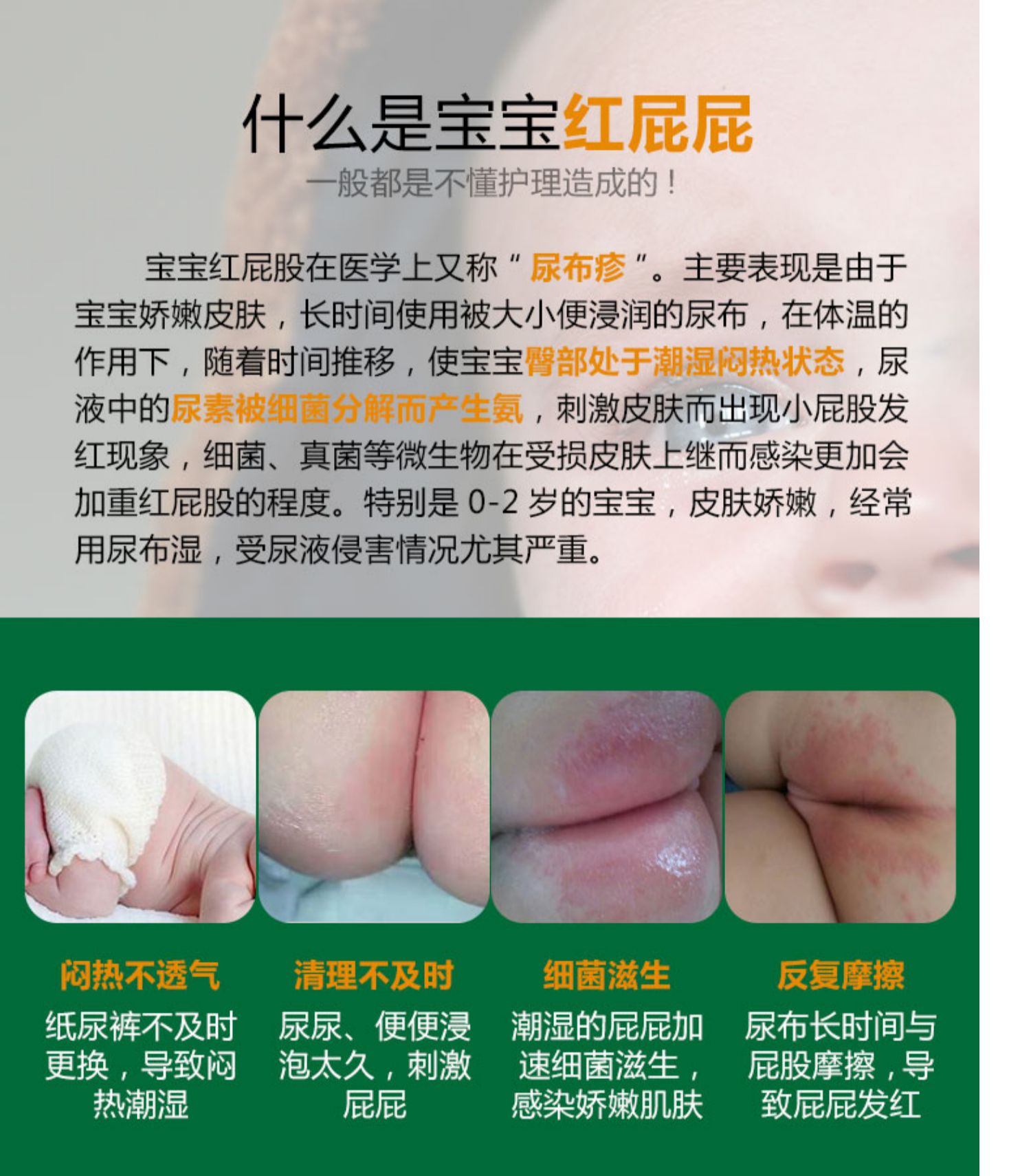 Kem chống nắng tốt cho trẻ sơ sinh kem tuyết tã trẻ em sơ sinh nhanh ngứa nóng đỏ ngứa sản phẩm chăm sóc da - Sản phẩm chăm sóc em bé tắm sữa tắm carrie junior